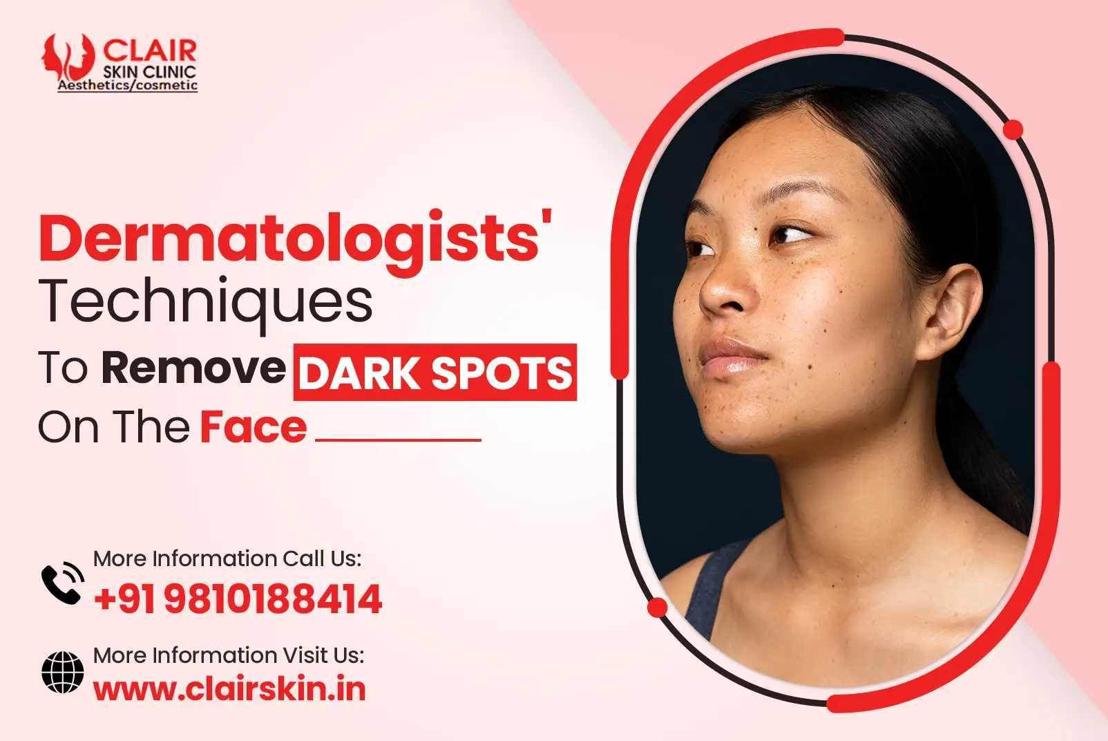 dermatologists-techniques-to-remove-dark-spots