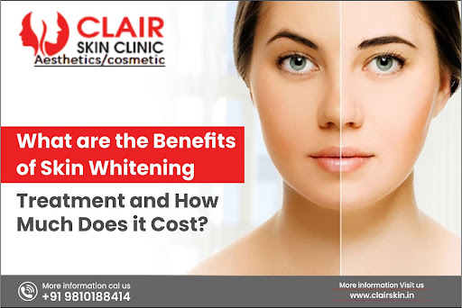 benefits-of-skin-whitening-treatment
