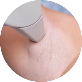 Transform Your Skin Today with laser hair removal in Delhi