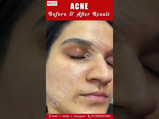 Video testimonial