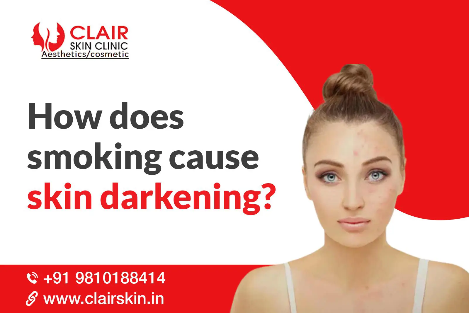 How Does Smoking Cause Skin Darkening? - Dermatologist in Delhi