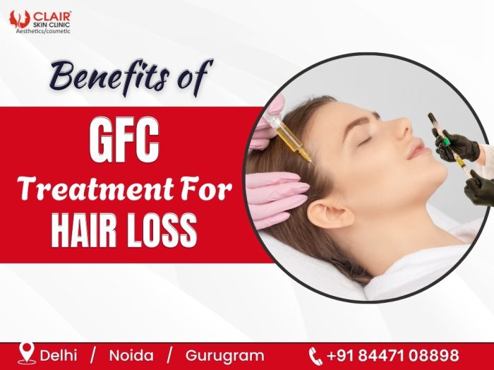 Benefits Of GFC Treatment For Hair Loss in Delhi NCR