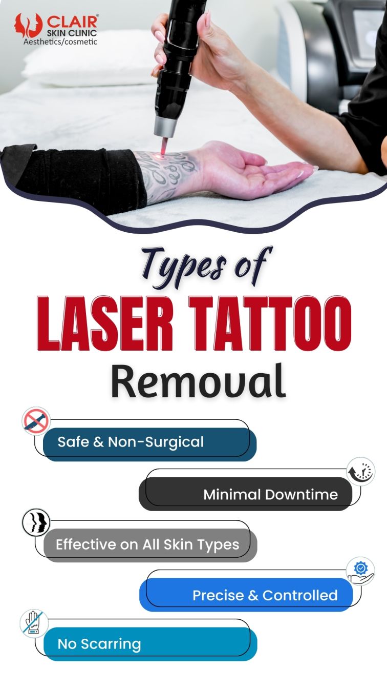 Benefits of Laser Tattoo Removal
