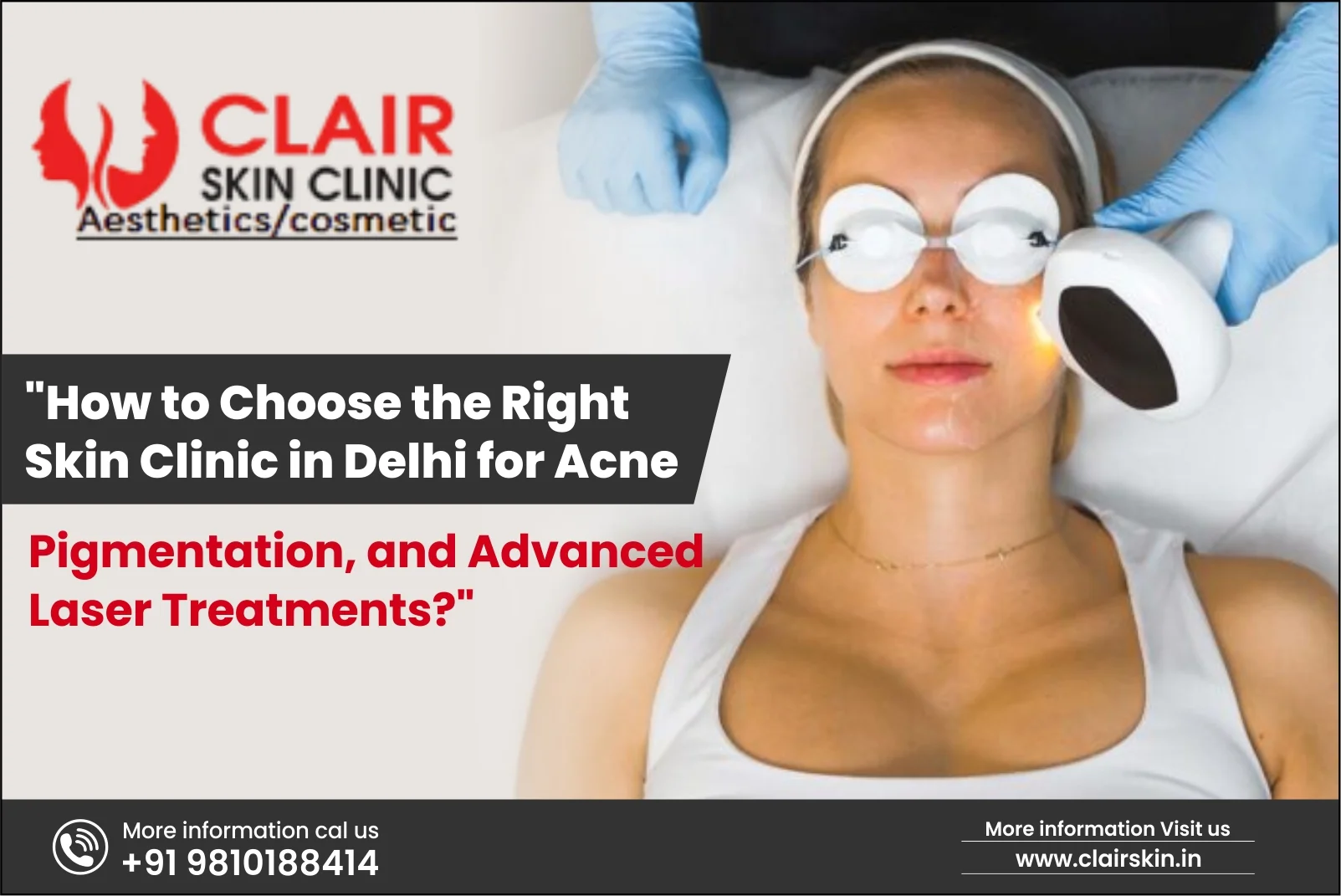 Skin Clinic in Delhi for Acne