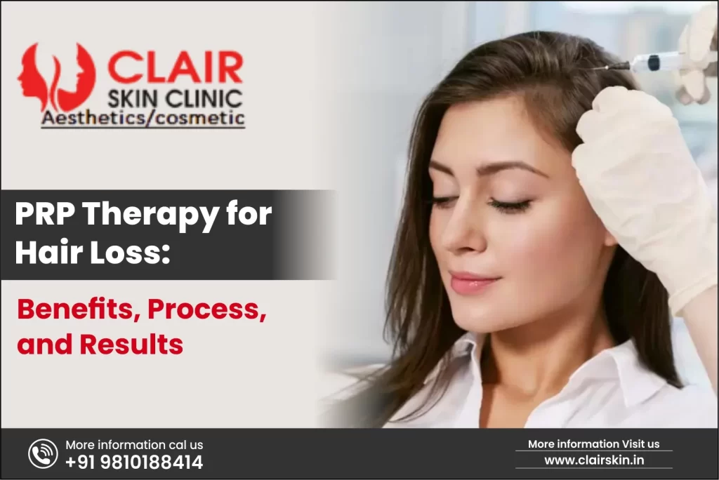PRP Therapy for Hair Loss