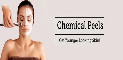 skin-brightening-chemical-peel-treatment
